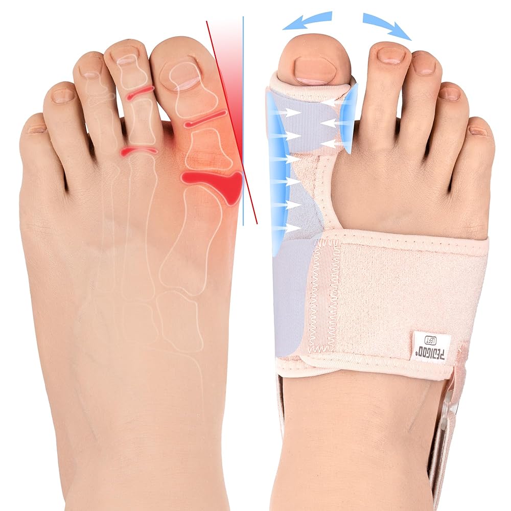 PEDIGOO Hallux Valgus Corrector for Women